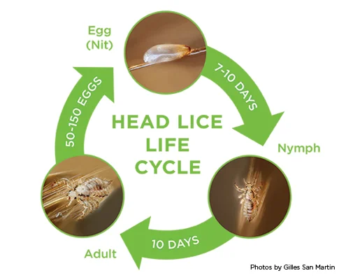 5 Surefire Ways lice Will Drive Your Business Into The Ground